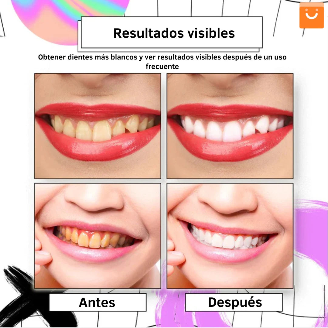 Sonrisa Brillante en Menos de 7 Días-Blanqueador Luxe Éclat