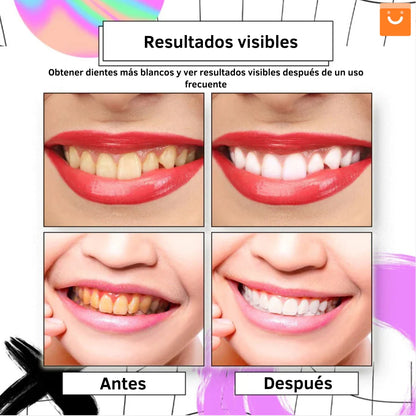 Sonrisa Brillante en Menos de 7 Días-Blanqueador Luxe Éclat
